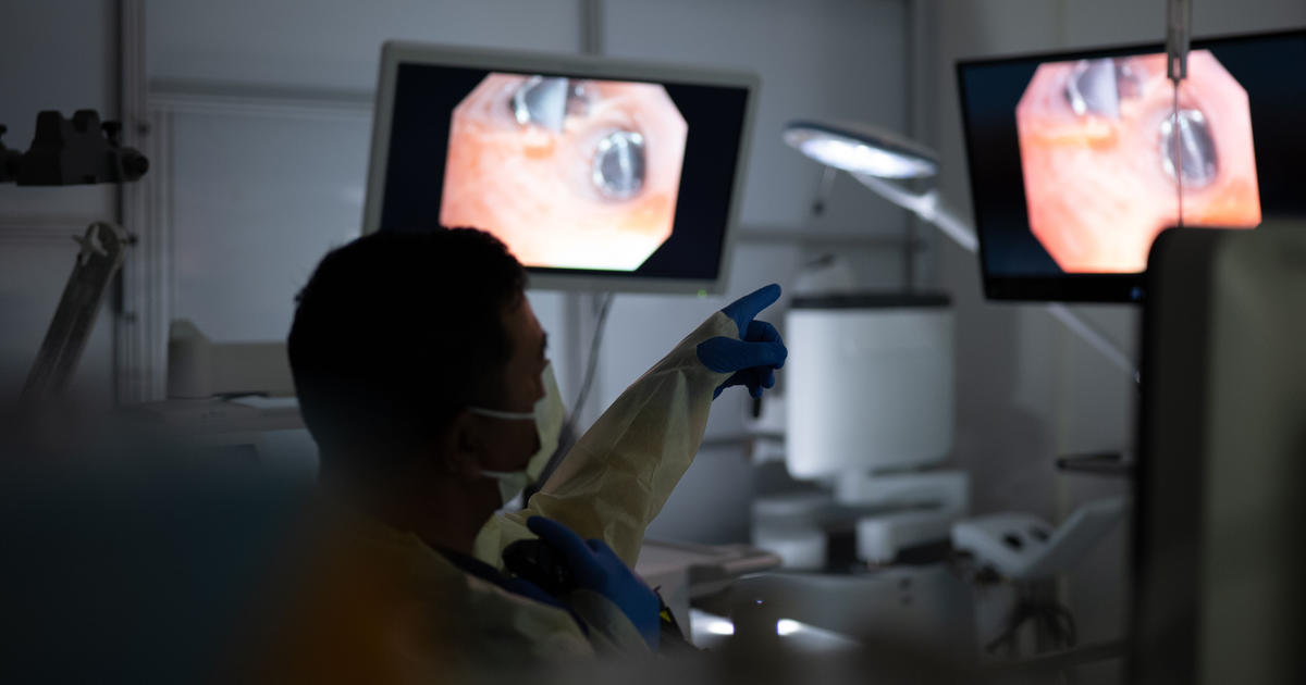 Small procedure, bigger breaths: UK HealthCare doctors improve breathing in COPD patients