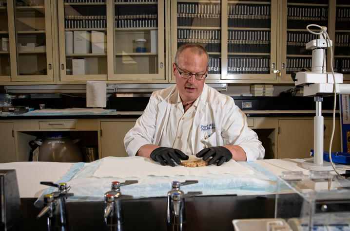 Dr. Pete Nelson in his lab at the Sanders-Brown Center on Aging. Nelson co-chaired an international workgroup that characterized another form of dementia. Mark Cornelison | UK Photo
