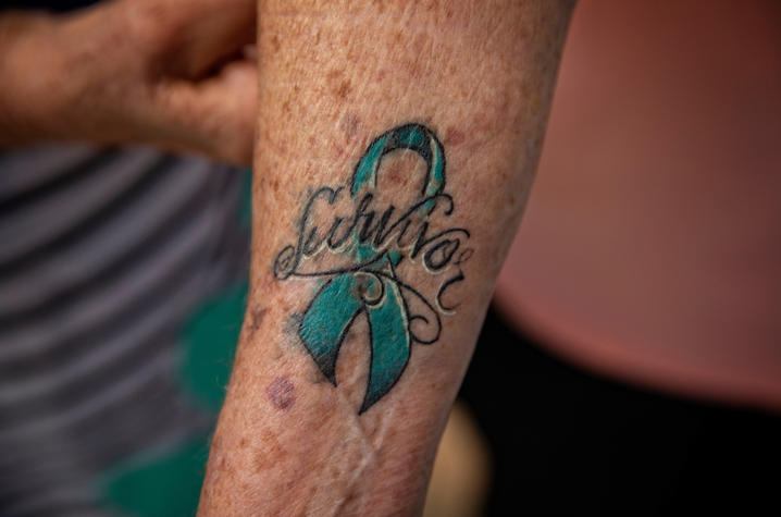 Tattoo on an ovarian cancer survivor