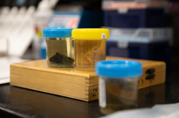 image of lung samples preserved in specimen containers