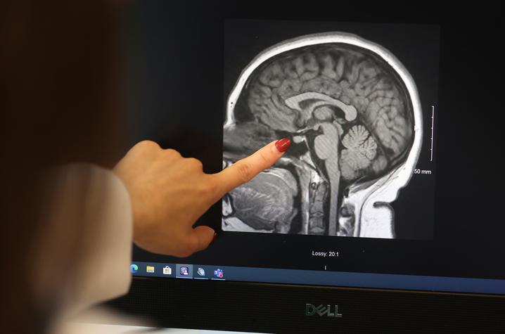 A hand points to an area on a MRI scan of the brain displayed on a computer monitor. The black-and-white medical image shows structures of the brain in profile, with measurement markings visible along the side of the scan.