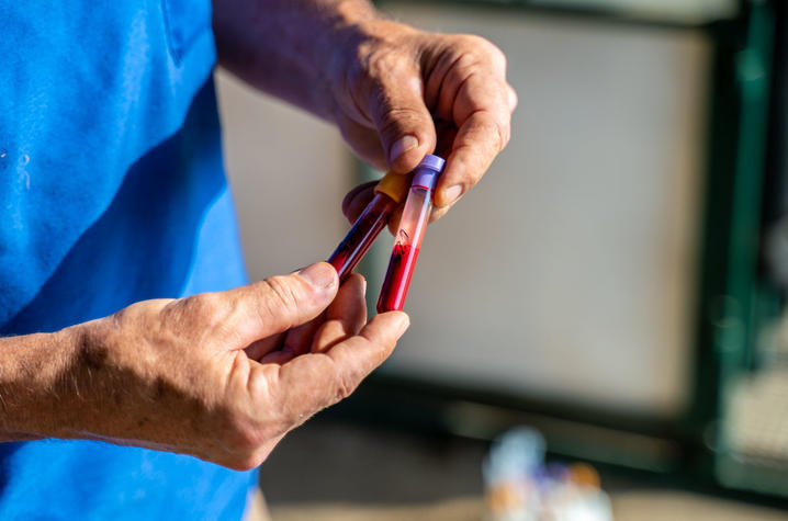 Blood samples drawn from alpacas contain virus-binding nanobodies that could confer passive immunity in humans and help fight a COVID-19 infection. Photo by Ben Corwin, Research Communications