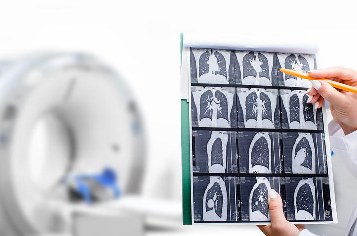 Lung CT scan