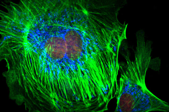Confocal image of fluorescently labelled proteins