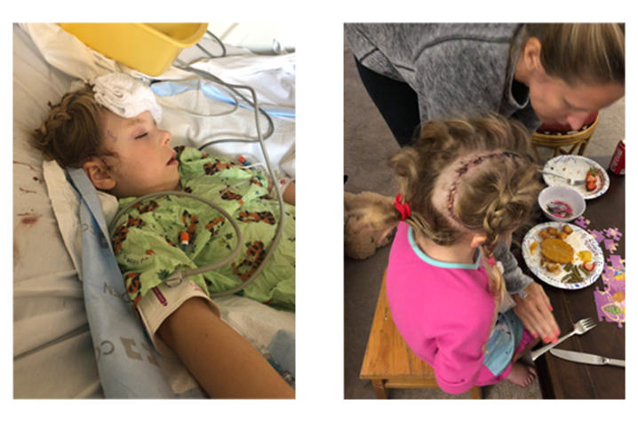 Two images of Sarah Beth in the hospital