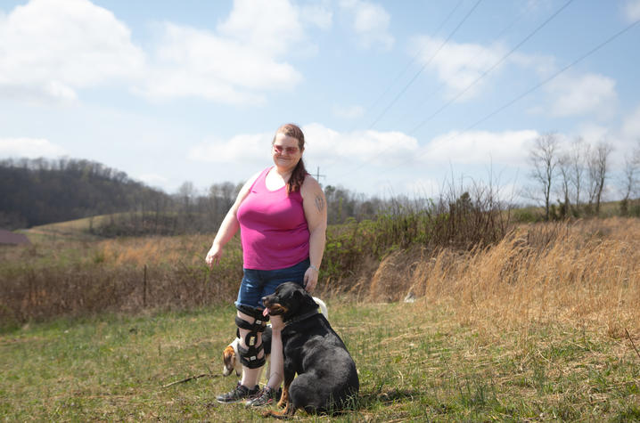 misty manning standing on a hill in her backyard with her two dogs. she's wearing a pink sleeveless shirt and denim shorts, and has braces on both of her knees. She's smiling.