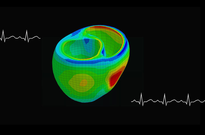 Photo of heart model