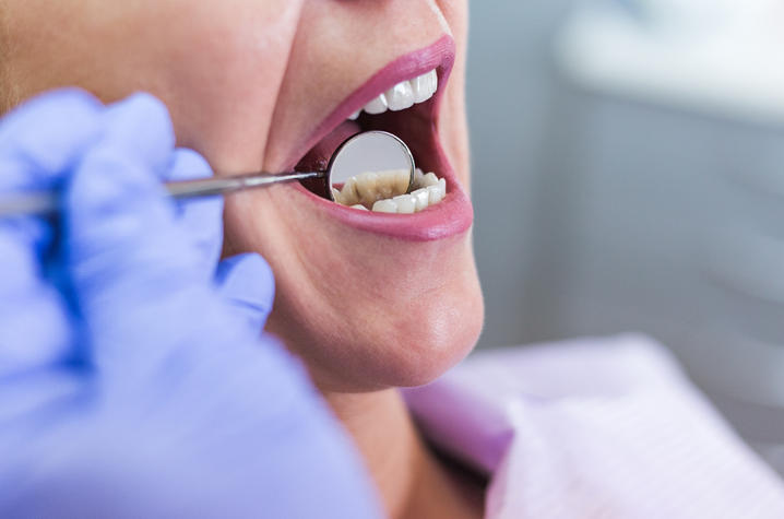 UKCD Offering Free Dental Screenings