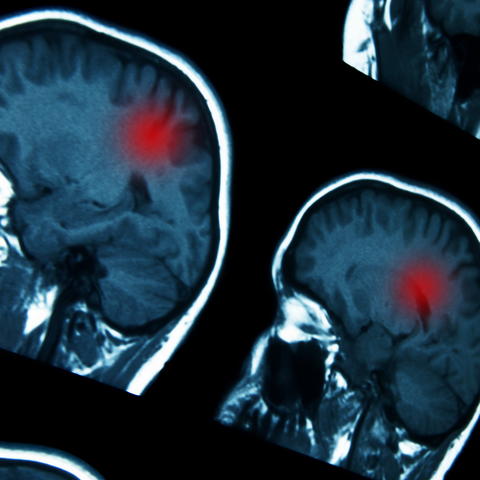 stock photo of brain scans