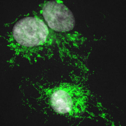 photo of macrophages from an African spiny mouse