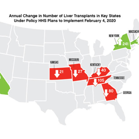 Graphic showing how the number of liver transplants in Kentucky will be affected with the new HHS policy.