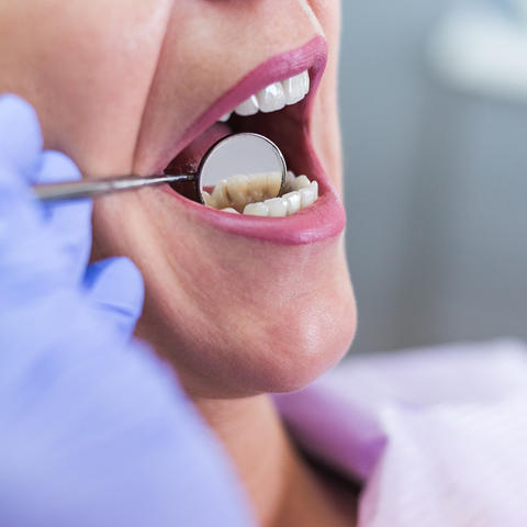 UKCD Offering Free Dental Screenings