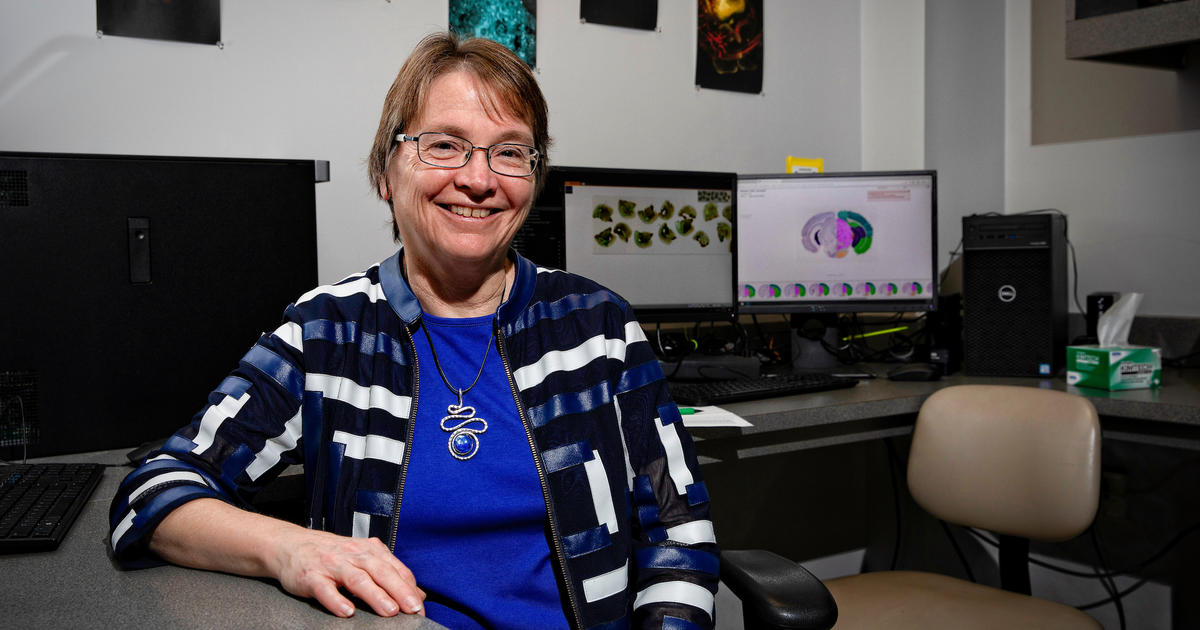 SandersBrown Director Leads First Human Study of Drug Targeting Brain Inflammation UKNow