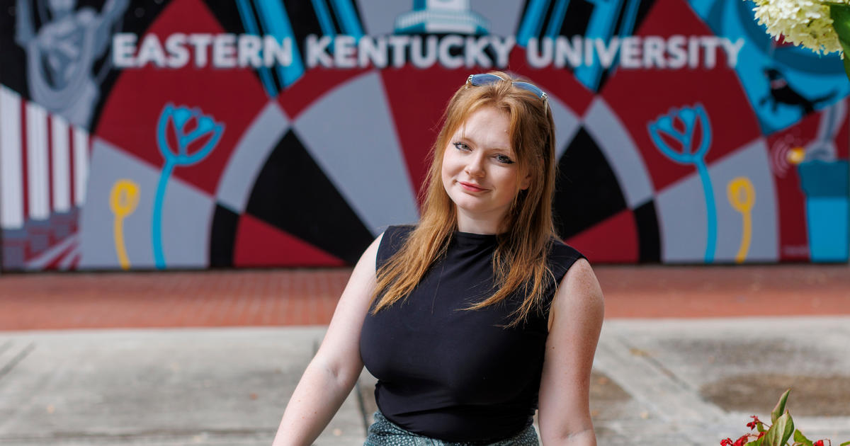 UK physicians restore college student’s vision after ‘false brain tumor’ UK physicians restore college student’s vision after ‘false brain tumor’