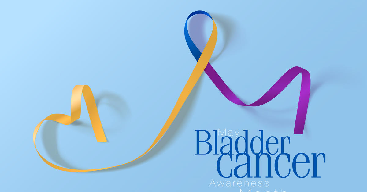 Awareness and Method of Preventing Bladder Cancer
