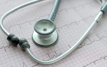 Close-up of a stethoscope resting on an electrocardiogram (ECG) printout showing heart rhythm tracings.