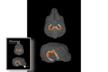 Pictured is an average MRI image of the group-wide volume increases to the hippocampus of middle-aged beagles over three years. The imaging was so compelling it was chosen as the cover art for the issue. Cover image: Jessica Noche
