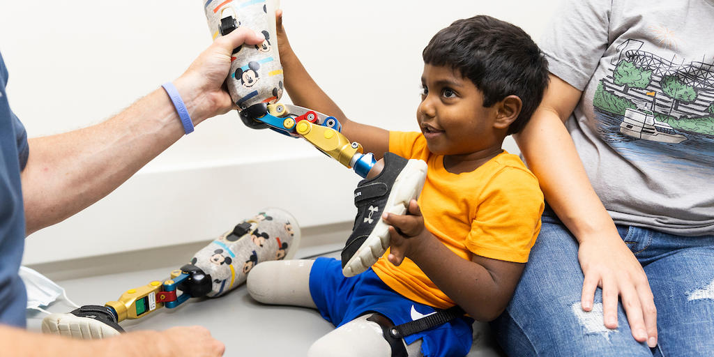 KCH, Shriners patient doesn't miss a step with new prosthetics - Vimarsana News
