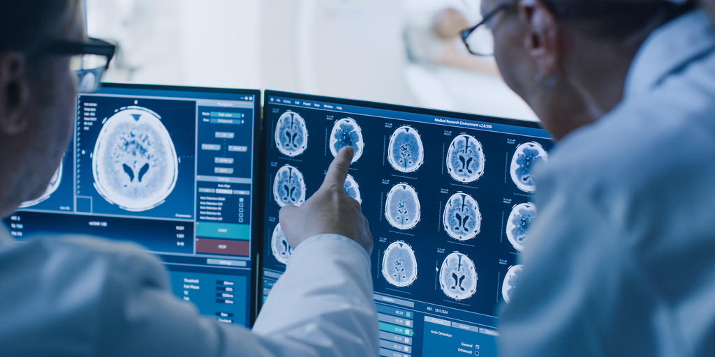 New MRI Technique Can Detect Early Dysfunction of Blood-Brain Barrier Associated With Small Vessel Disease - Vimarsana News