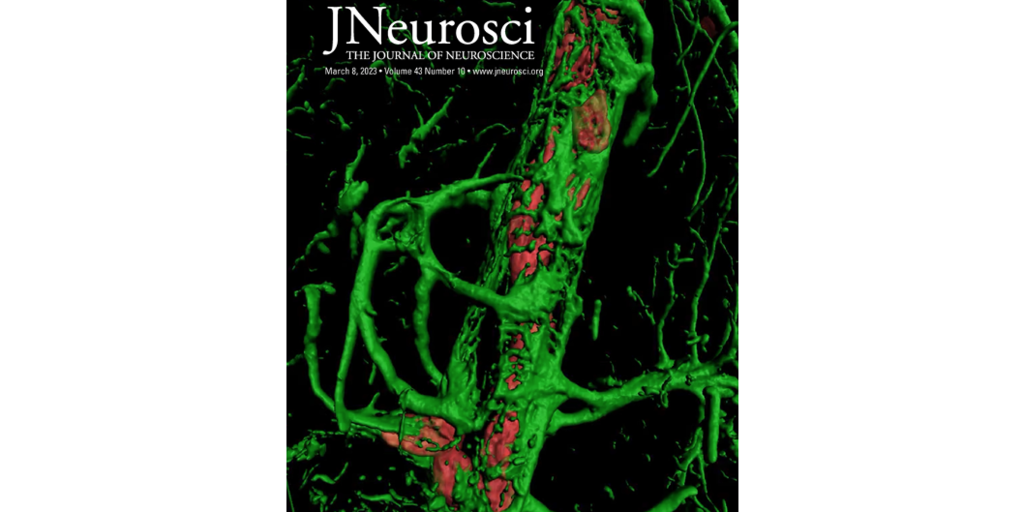 Sanders-Brown publication makes cover of recent Journal of Neuroscience issue - Vimarsana News