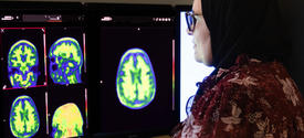 A woman wearing glasses and a headscarf studies colorful brain scan images displayed on two computer monitors in a medical research setting.
