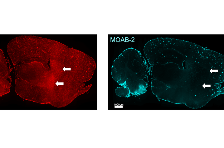 Putting out the kitchen fire Scientific brain images showing fluorescent staining of brain tissue. Colored markers highlight immune cells and amyloid plaques, with arrows indicating regions of interest used to study Alzheimer’s disease-related changes in the brain.