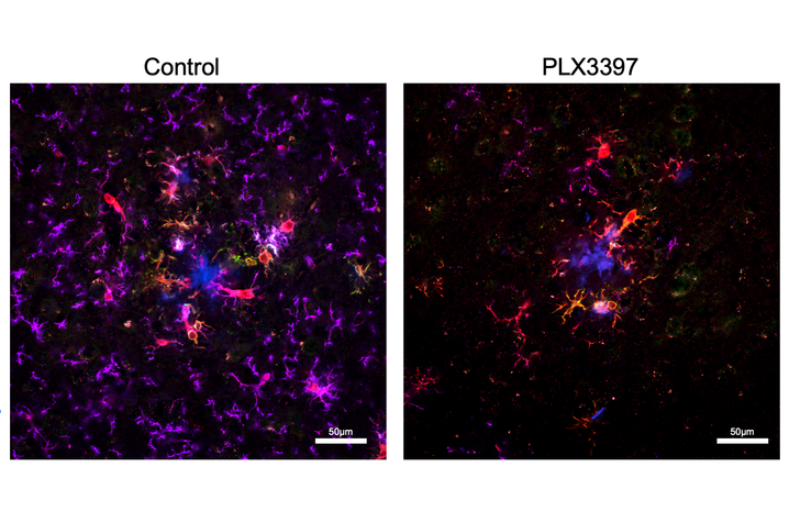 On and off Side-by-side microscopic images compare brain tissue from a control sample and a PLX3397-treated sample. Fluorescent colors identify amyloid plaques, immune cells, and other cellular markers used to examine changes associated with Alzheimer’s disease.