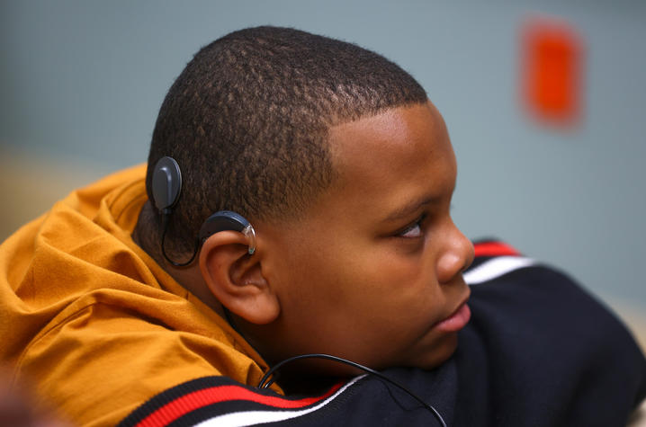 DuJuan Broadus Jr. with his new cochlear implant.