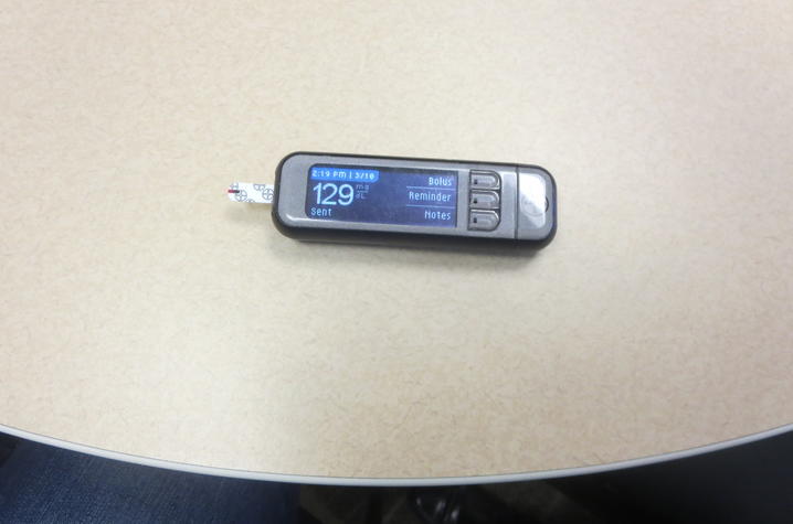 The glucometer, used to test blood glucose levels, feeds information to the insulin pump.