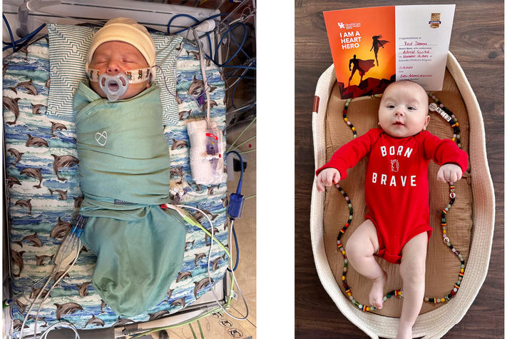 array of images; on left, Reid swaddled in a bed in the NICU. On right, Reid with a onesie that says 'born brave'