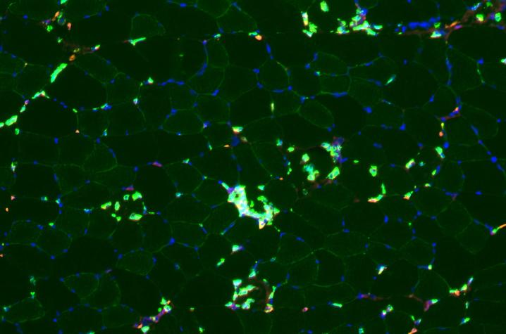 Photo of macrophages in muscle cells after strenuous exercise