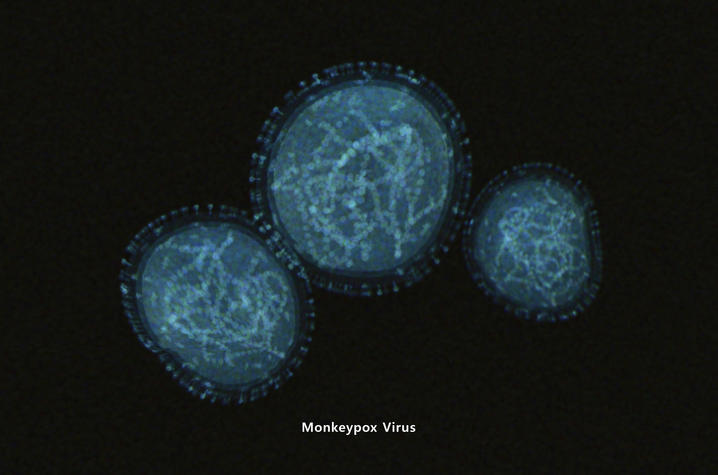 monkeypox virus