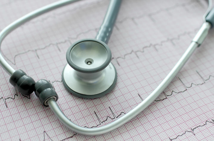 Close-up of a stethoscope resting on an electrocardiogram (ECG) printout showing heart rhythm tracings.