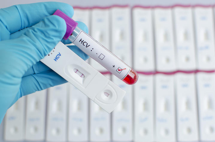 hepatitis C test