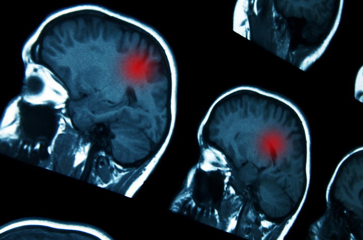 stock photo of brain scans