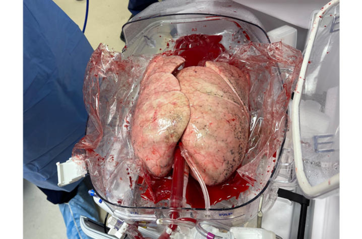 Image of a pair of lungs in transport machine.