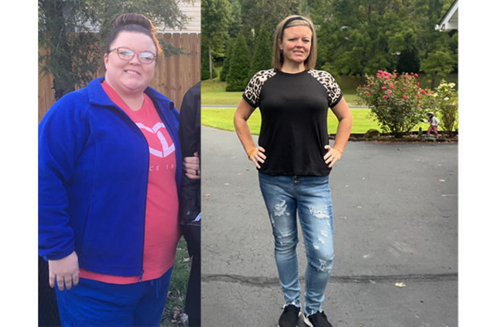 Image of before and after Maria’s weight loss surgery