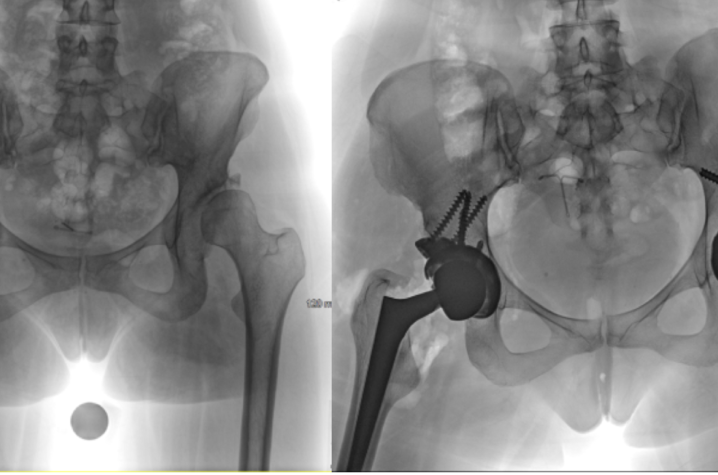 X-Rays of Angela Chaney