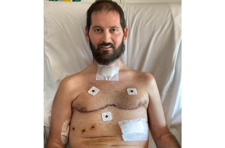 Image of Andy smiling in hospital bed after lung transplant.