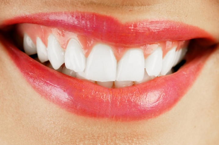 uk-women-dentists-give-the-gift-of-a-healthy-smile-uknow