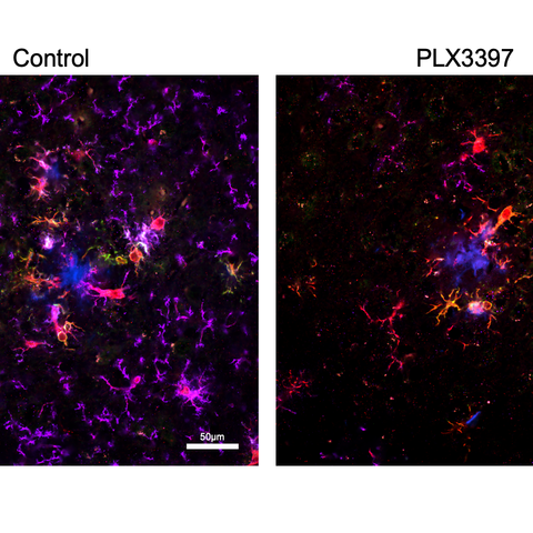 Side-by-side microscopic images compare brain tissue from a control sample and a PLX3397-treated sample. Fluorescent colors identify amyloid plaques, immune cells, and other cellular markers used to examine changes associated with Alzheimer’s disease.