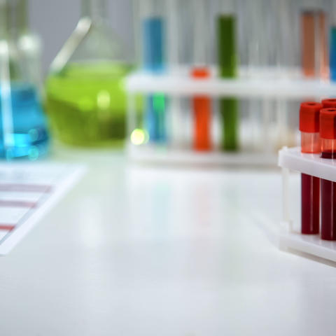 photo of blood samples in lab