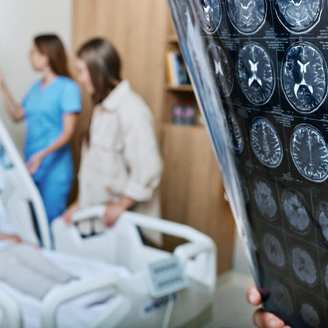  close-up of a hand holding a brain MRI scan, with multiple cross-section images visible, while in the background a patient lies in a hospital bed as two clinicians stand nearby discussing care.