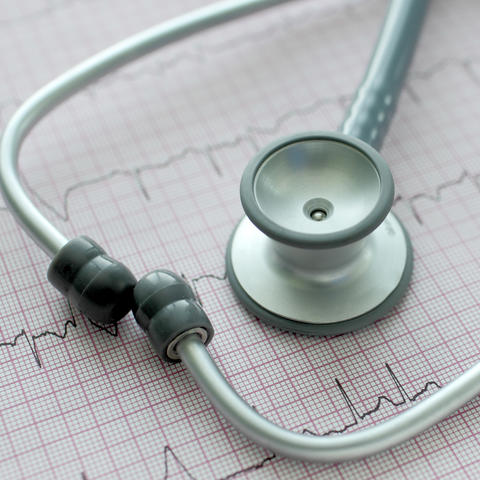 Close-up of a stethoscope resting on an electrocardiogram (ECG) printout showing heart rhythm tracings.