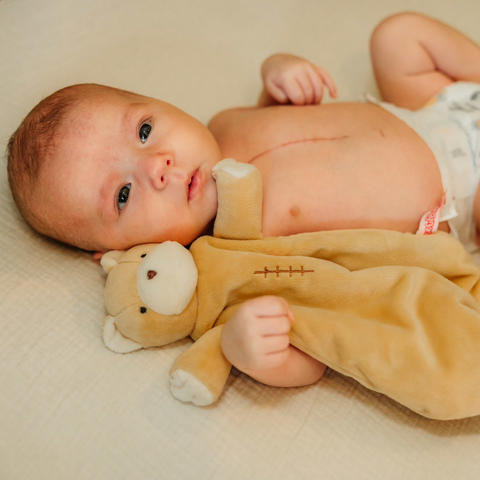 Image of baby Reid with his surgical scar, and his toy bear with the same scar