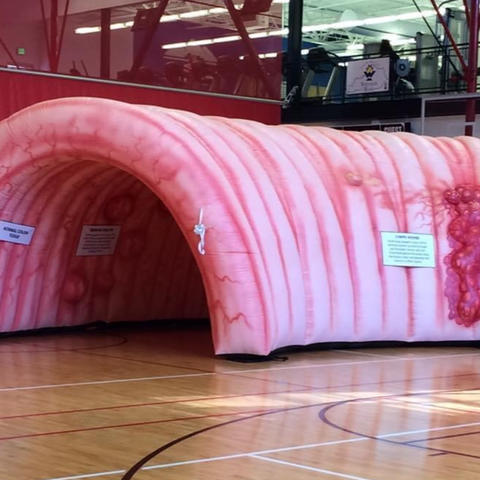 The 12-foot inflatable colon