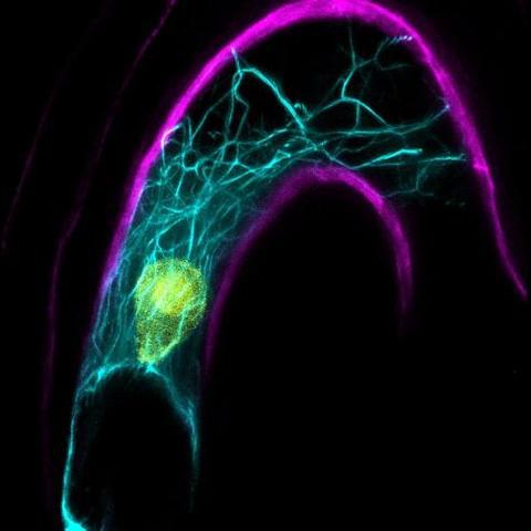 A confocal microscope image of the Arabidopsis female cell including the nucleus in yellow and intracellular cables which help with sperm nucleus migration upon fertilization. The cell wall is pictured in magenta.